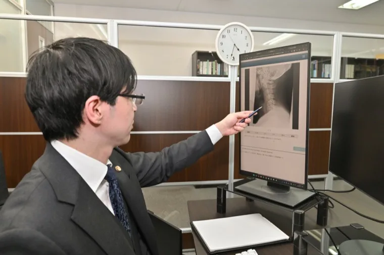 交通事故の頸椎MRI画像をパソコンで確認する弁護士